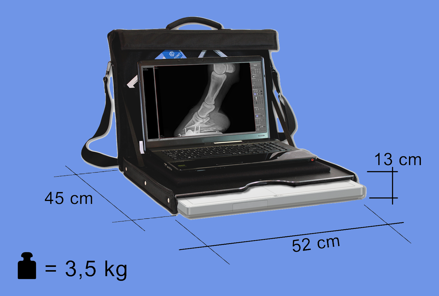 meX1417LGW suitcase dimensions